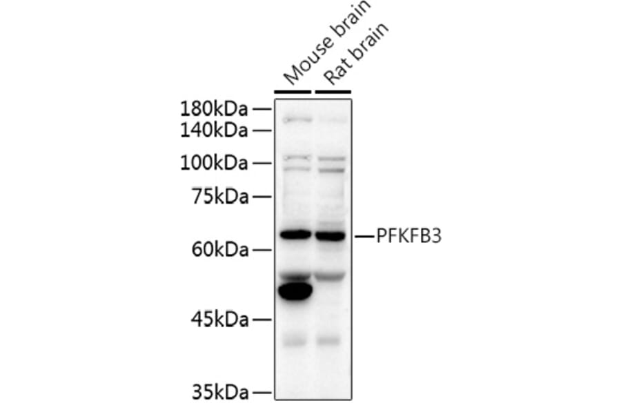 Western Blot - Anti-PFKFB3 Antibody (A15442) - Antibodies.com