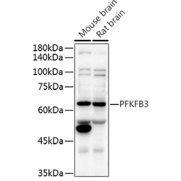 Western Blot - Anti-PFKFB3 Antibody (A15442) - Antibodies.com
