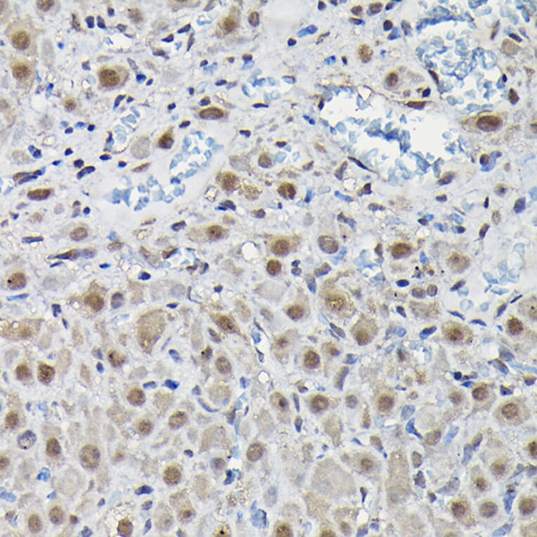 Immunohistochemistry - Anti-PFKFB3 Antibody (A15442) - Antibodies.com
