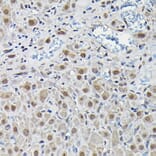 Immunohistochemistry - Anti-PFKFB3 Antibody (A15442) - Antibodies.com