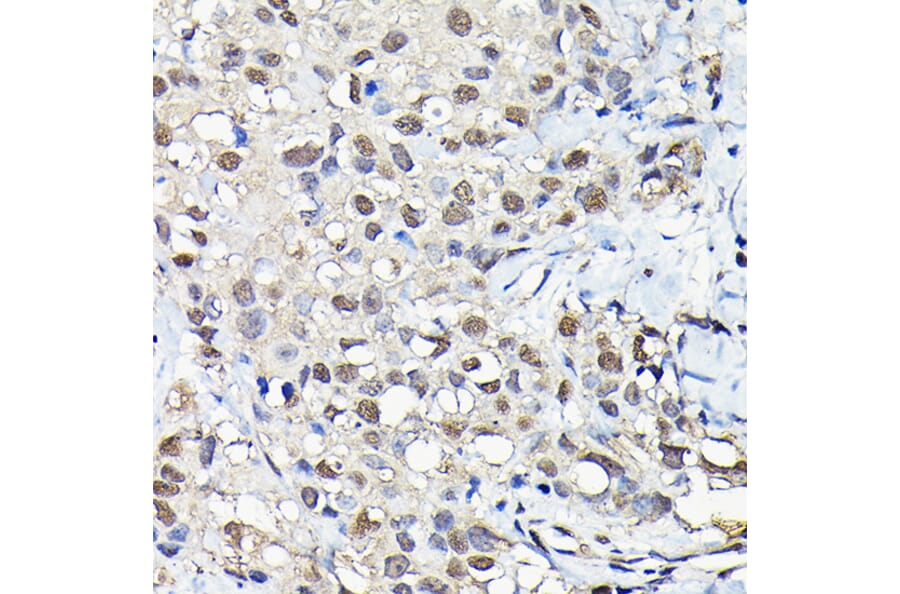 Immunohistochemistry - Anti-PFKFB3 Antibody (A15442) - Antibodies.com