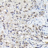 Immunohistochemistry - Anti-PFKFB3 Antibody (A15442) - Antibodies.com