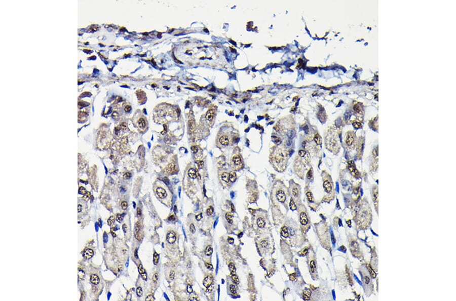Immunohistochemistry - Anti-PFKFB3 Antibody (A15442) - Antibodies.com