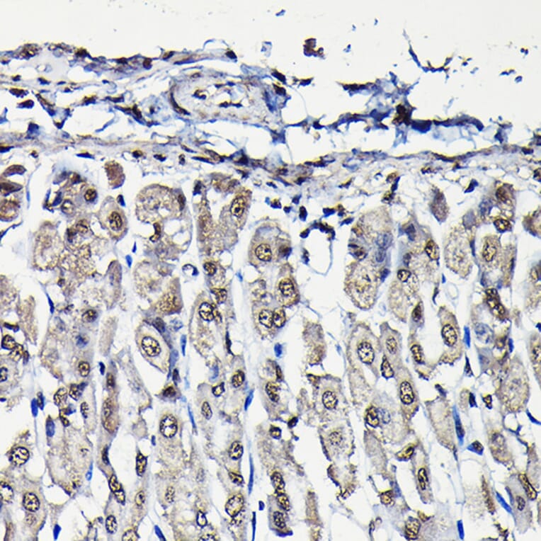 Immunohistochemistry - Anti-PFKFB3 Antibody (A15442) - Antibodies.com