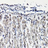 Immunohistochemistry - Anti-PFKFB3 Antibody (A15442) - Antibodies.com
