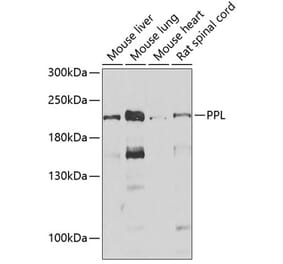 Western Blot - Anti-Periplakin Antibody (A15446) - Antibodies.com