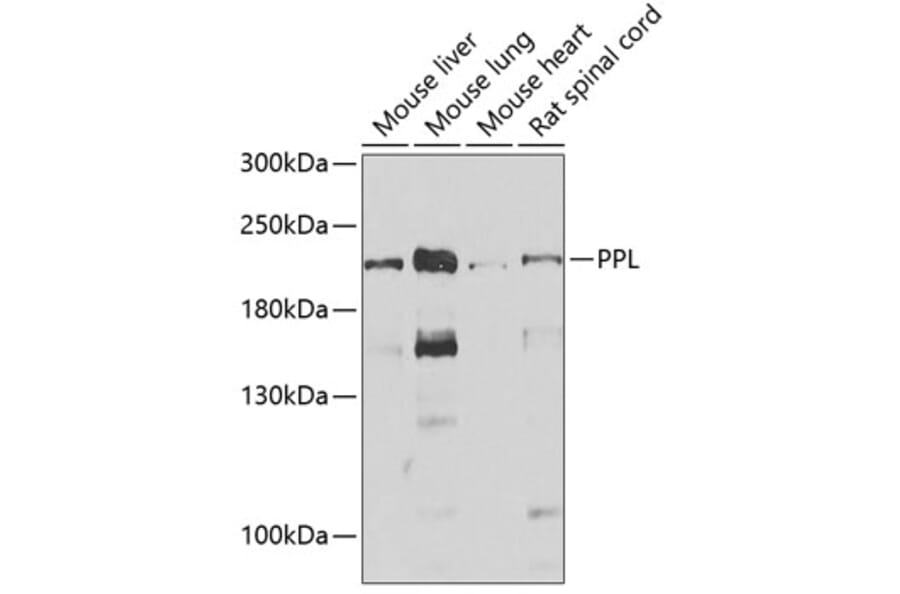 Western Blot - Anti-Periplakin Antibody (A15446) - Antibodies.com