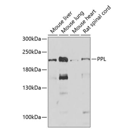 Western Blot - Anti-Periplakin Antibody (A15446) - Antibodies.com