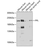 Western Blot - Anti-Periplakin Antibody (A15446) - Antibodies.com