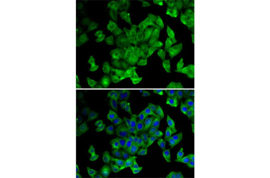 Immunofluorescence - Anti-Periplakin Antibody (A15446) - Antibodies.com