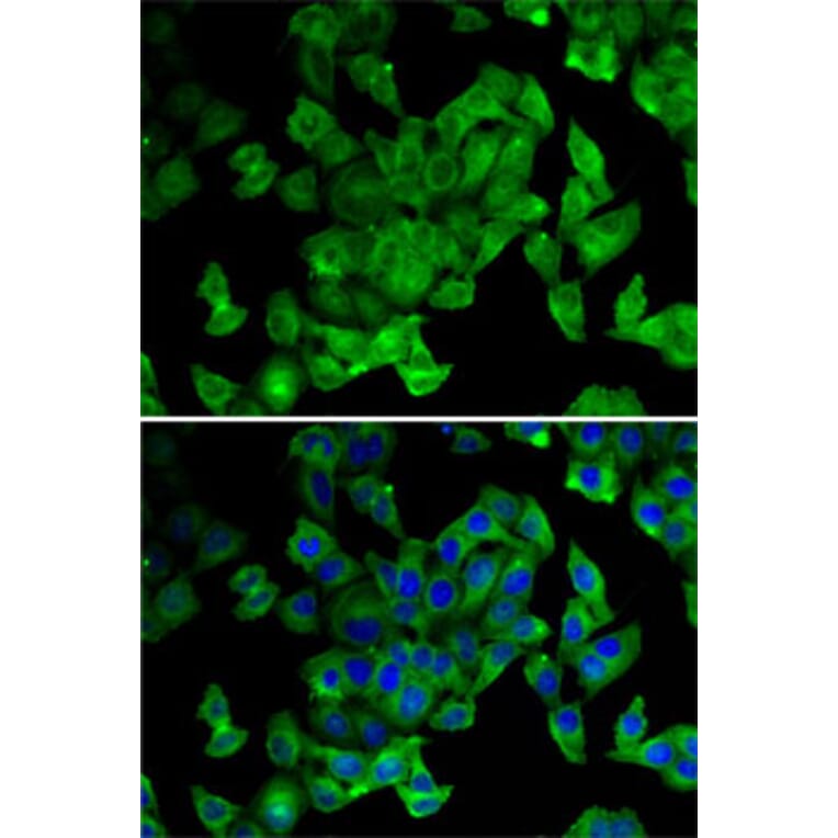 Immunofluorescence - Anti-Periplakin Antibody (A15446) - Antibodies.com