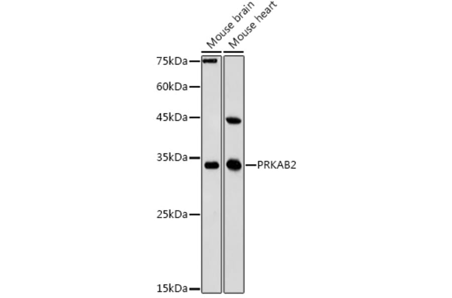 Western Blot - Anti-AMPK beta 2/PRKAB2 Antibody (A15447) - Antibodies.com