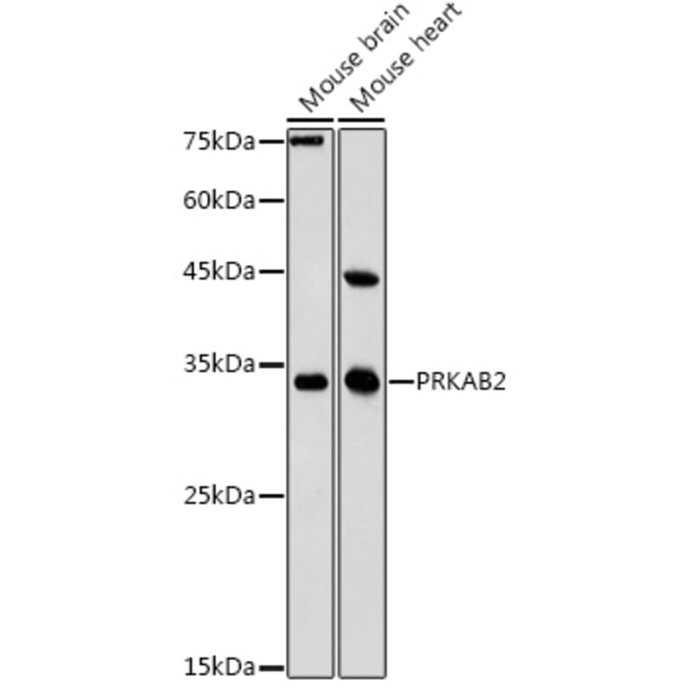 Western Blot - Anti-AMPK beta 2/PRKAB2 Antibody (A15447) - Antibodies.com
