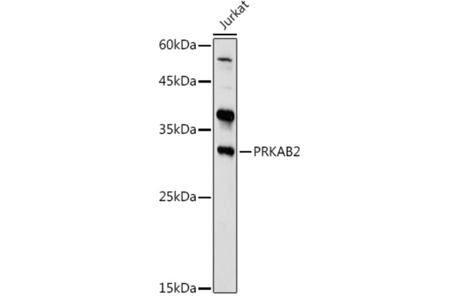 Western Blot - Anti-AMPK beta 2/PRKAB2 Antibody (A15447) - Antibodies.com