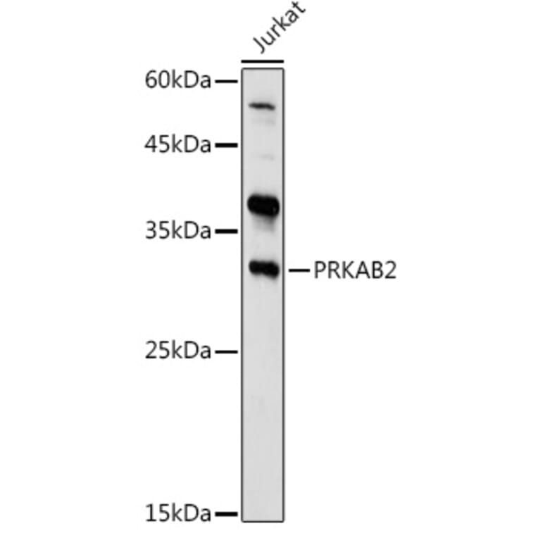 Western Blot - Anti-AMPK beta 2/PRKAB2 Antibody (A15447) - Antibodies.com