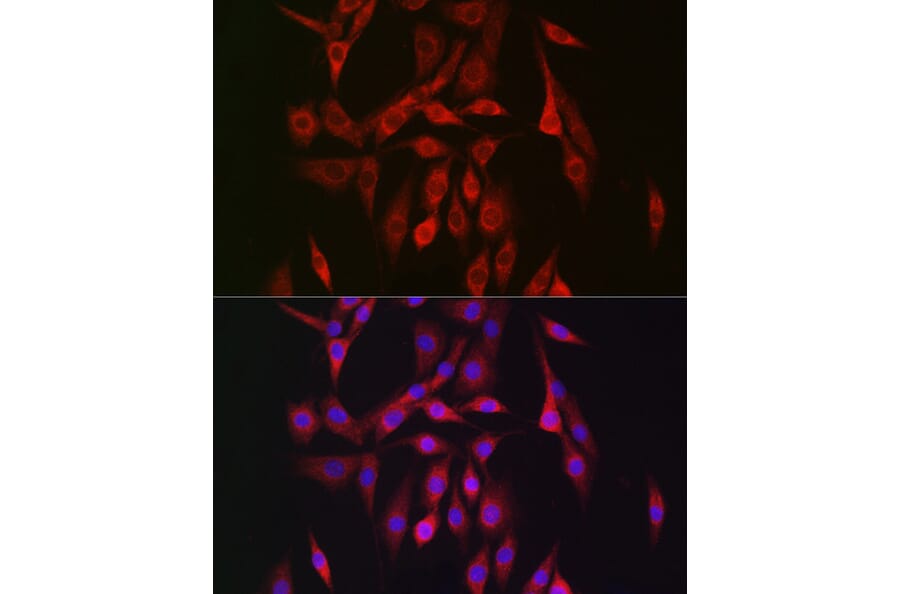 Immunofluorescence - Anti-AMPK beta 2/PRKAB2 Antibody (A15447) - Antibodies.com