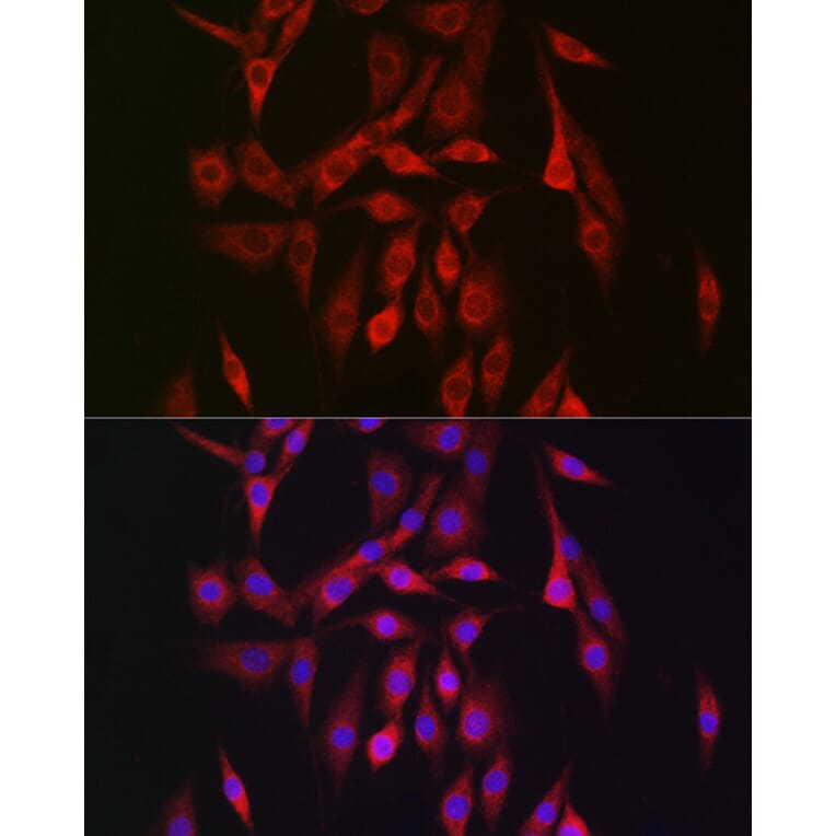 Immunofluorescence - Anti-AMPK beta 2/PRKAB2 Antibody (A15447) - Antibodies.com