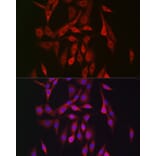 Immunofluorescence - Anti-AMPK beta 2/PRKAB2 Antibody (A15447) - Antibodies.com