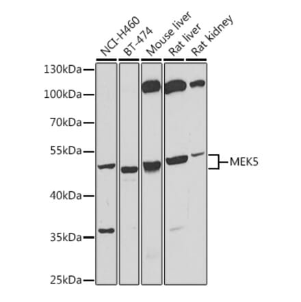 Western Blot - Anti-MEK5 Antibody (A15448) - Antibodies.com