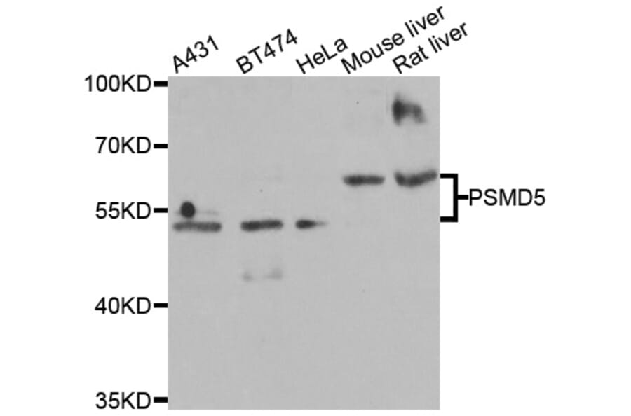 Western Blot - Anti-PSMD5 Antibody (A6954) - Antibodies.com