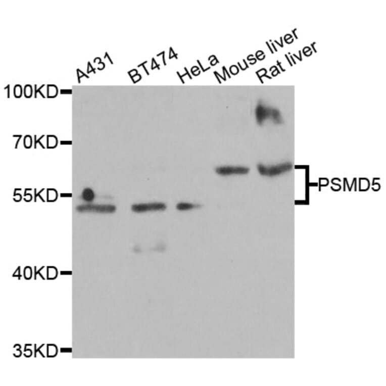 Western Blot - Anti-PSMD5 Antibody (A6954) - Antibodies.com