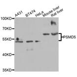 Western Blot - Anti-PSMD5 Antibody (A6954) - Antibodies.com