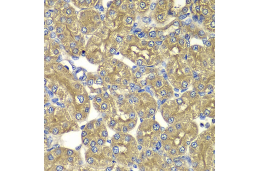 Immunohistochemistry - Anti-PSMD5 Antibody (A6954) - Antibodies.com