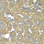 Immunohistochemistry - Anti-PSMD5 Antibody (A6954) - Antibodies.com