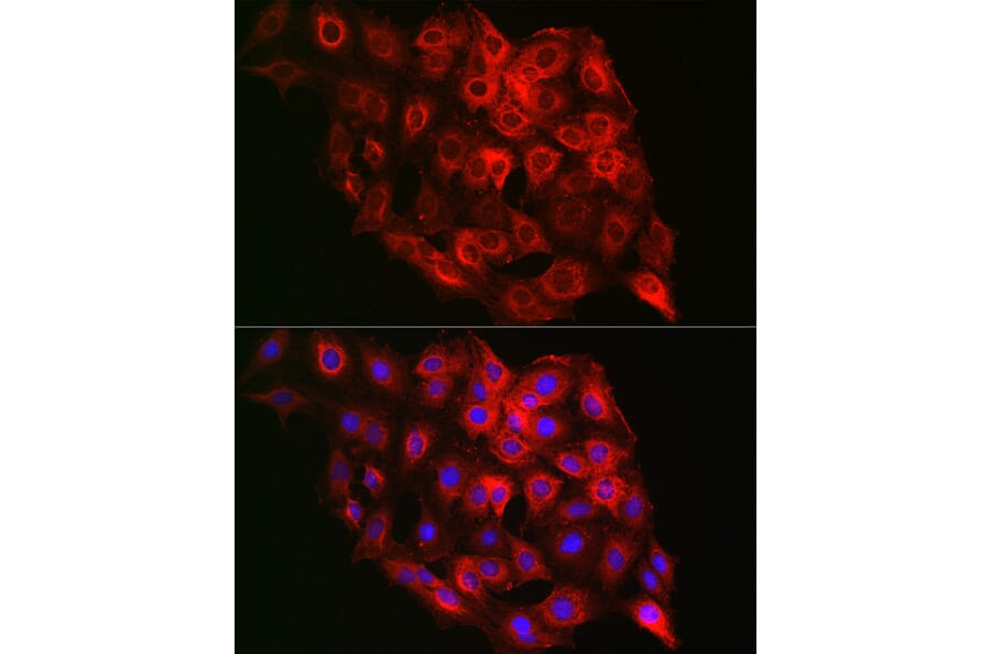 Immunofluorescence - Anti-PSMD8 Antibody (A15450) - Antibodies.com