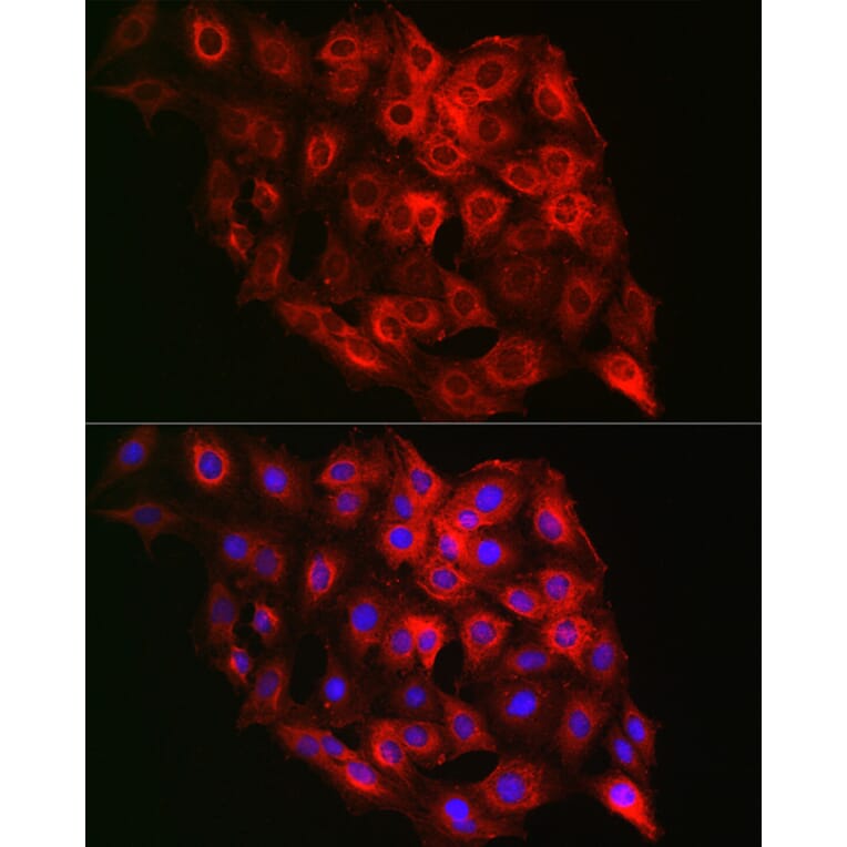 Immunofluorescence - Anti-PSMD8 Antibody (A15450) - Antibodies.com