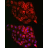 Immunofluorescence - Anti-PSMD8 Antibody (A15450) - Antibodies.com