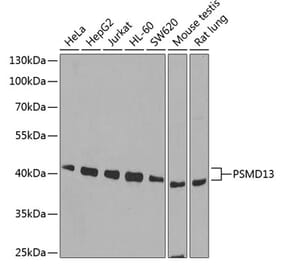 Western Blot - Anti-PSMD13 Antibody (A15451) - Antibodies.com