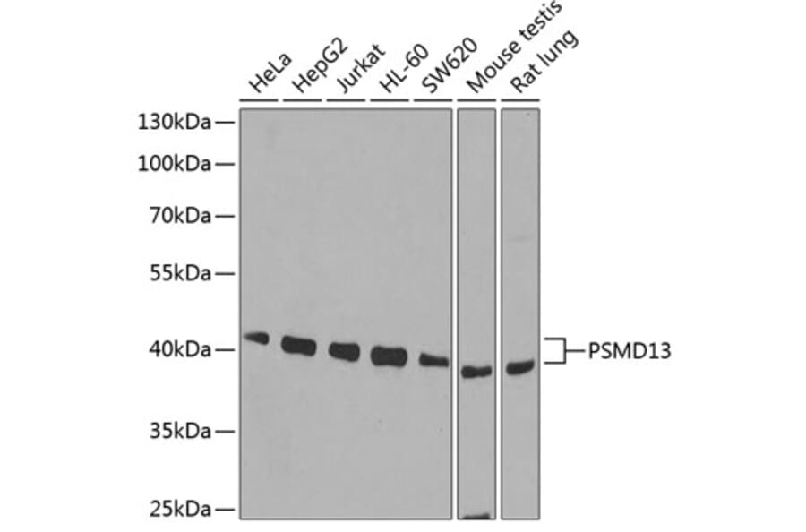 Western Blot - Anti-PSMD13 Antibody (A15451) - Antibodies.com