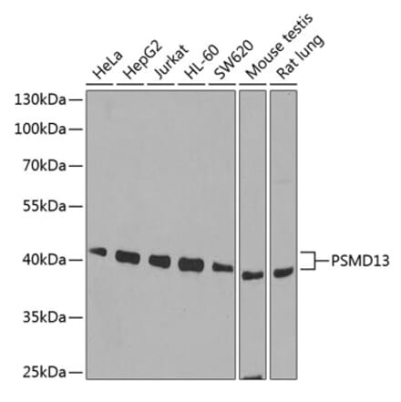 Western Blot - Anti-PSMD13 Antibody (A15451) - Antibodies.com