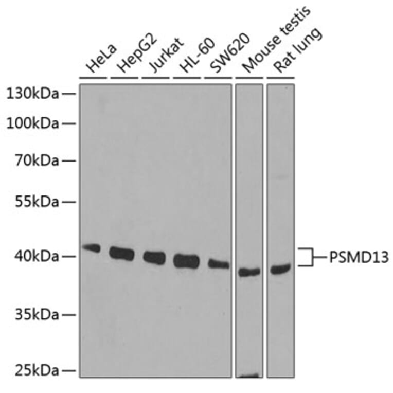 Western Blot - Anti-PSMD13 Antibody (A15451) - Antibodies.com