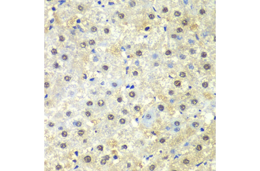 Immunohistochemistry - Anti-PSMD13 Antibody (A15451) - Antibodies.com