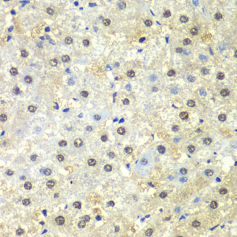 Immunohistochemistry - Anti-PSMD13 Antibody (A15451) - Antibodies.com