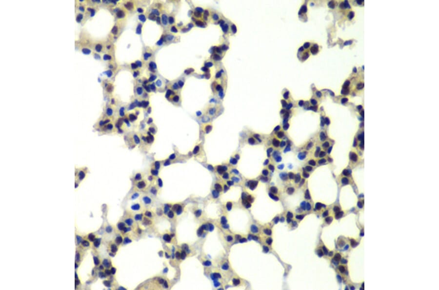 Immunohistochemistry - Anti-PSMD13 Antibody (A15451) - Antibodies.com