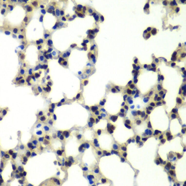 Immunohistochemistry - Anti-PSMD13 Antibody (A15451) - Antibodies.com