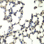 Immunohistochemistry - Anti-PSMD13 Antibody (A15451) - Antibodies.com