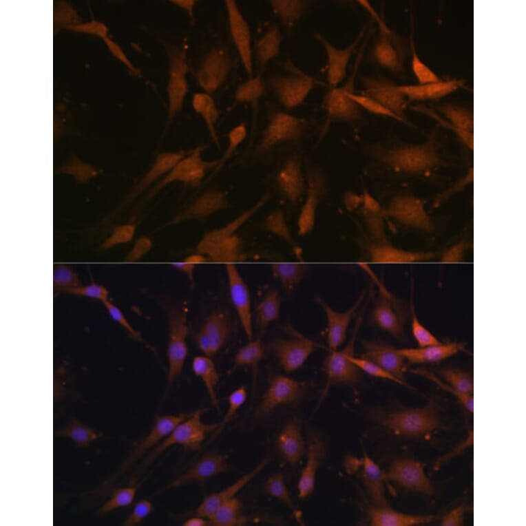Immunofluorescence - Anti-PSMD13 Antibody (A15451) - Antibodies.com