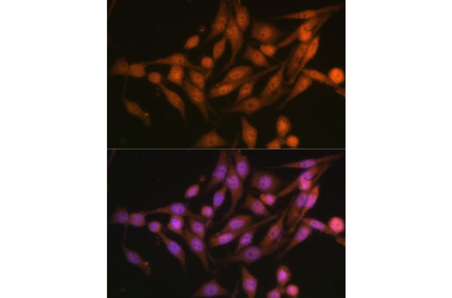 Immunofluorescence - Anti-PSMD13 Antibody (A15451) - Antibodies.com