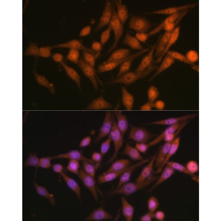 Immunofluorescence - Anti-PSMD13 Antibody (A15451) - Antibodies.com