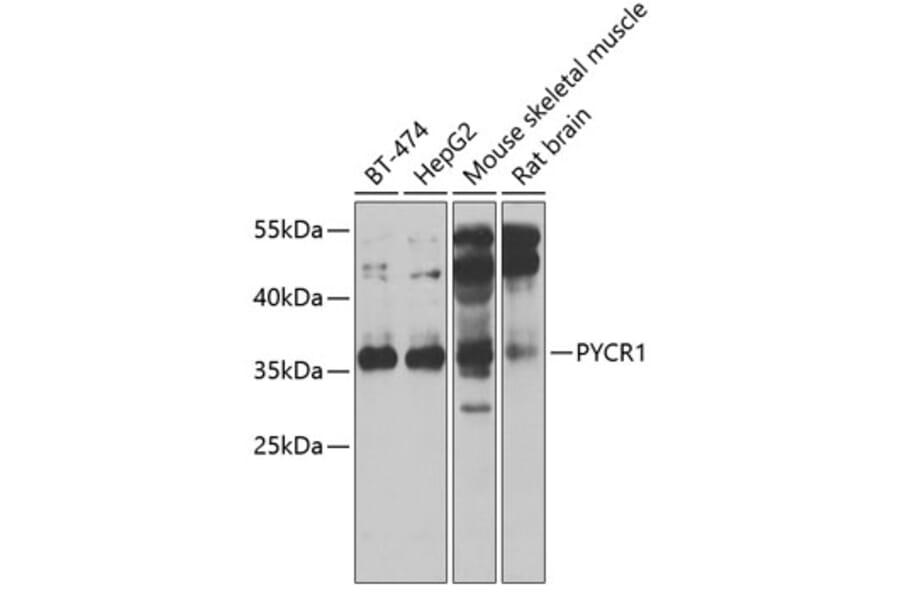 Western Blot - Anti-PYCR1 Antibody (A15452) - Antibodies.com