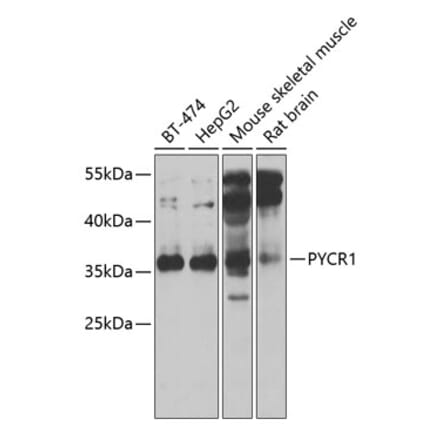 Western Blot - Anti-PYCR1 Antibody (A15452) - Antibodies.com