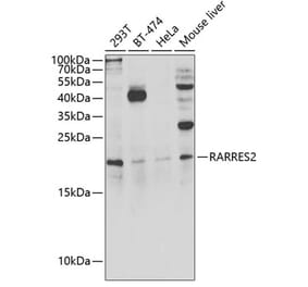 Western Blot - Anti-Chemerin Antibody (A15453) - Antibodies.com