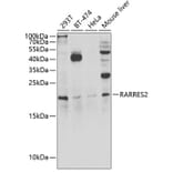 Western Blot - Anti-Chemerin Antibody (A15453) - Antibodies.com