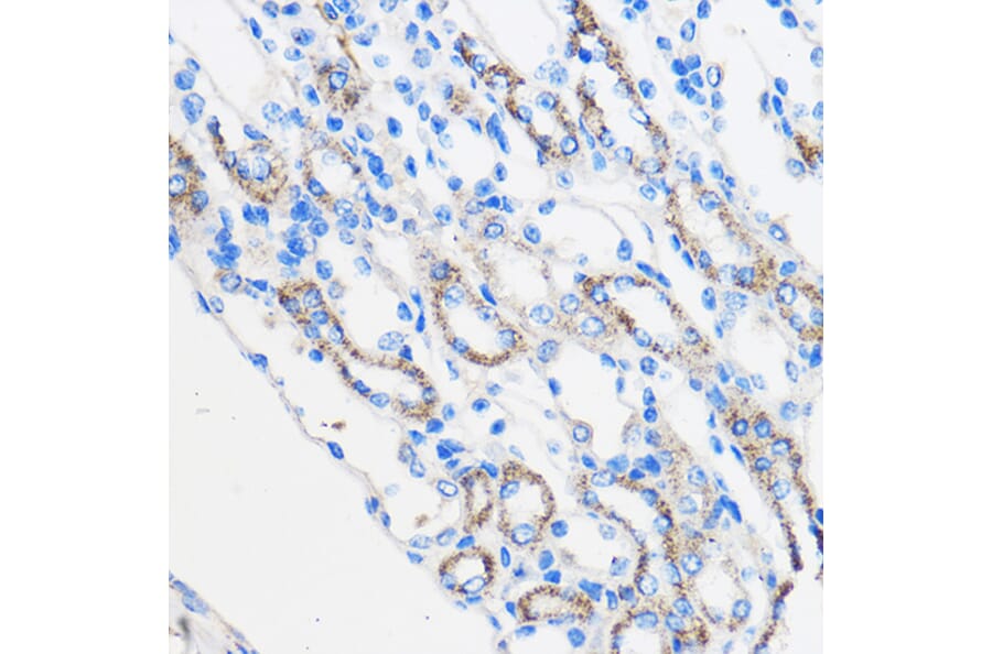 Immunohistochemistry - Anti-Chemerin Antibody (A15453) - Antibodies.com