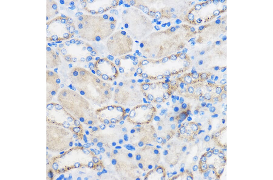 Immunohistochemistry - Anti-Chemerin Antibody (A15453) - Antibodies.com