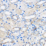 Immunohistochemistry - Anti-Chemerin Antibody (A15453) - Antibodies.com